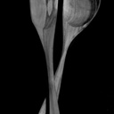 Paire de cuillère de service