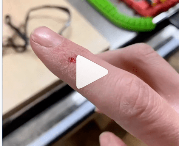 SawStop sans la saucisse ??